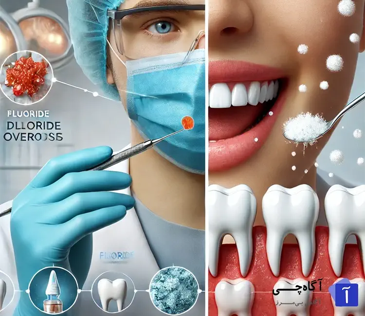 مراقبت های بعد از درمان با فلوراید