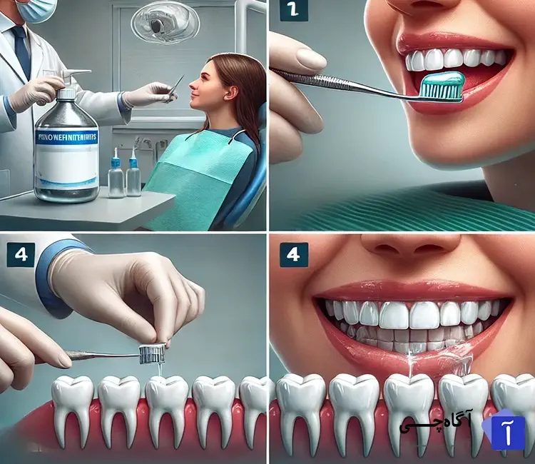 مزایا و عوارض محافظت از دندان با فلوراید